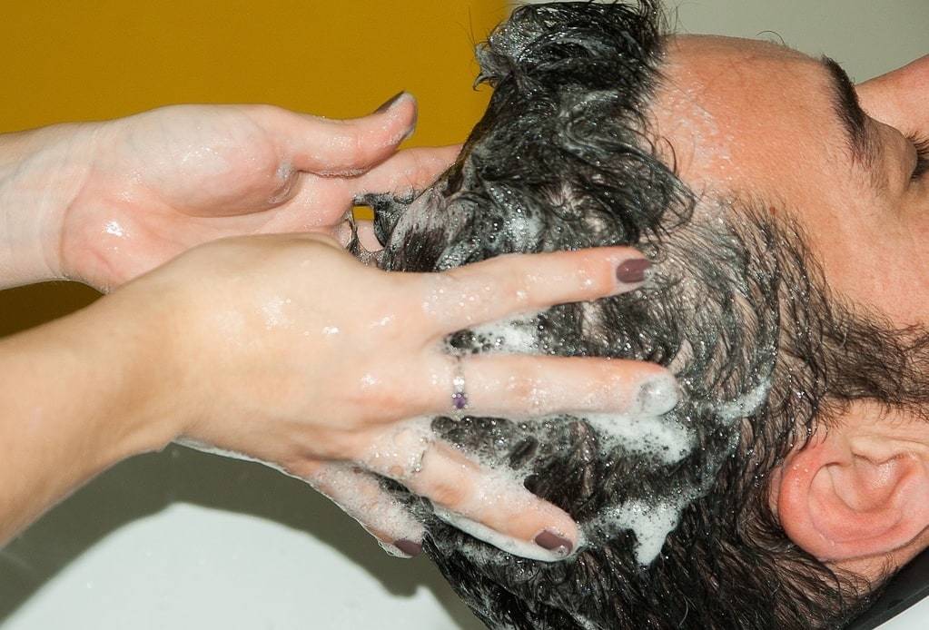 Reprenez le contrôle de votre chevelure : greffe de cheveux